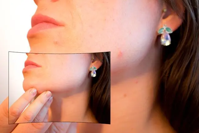 Spot, Wrinkle, and Blemish Removal.